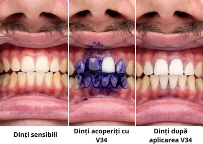 Smilekit